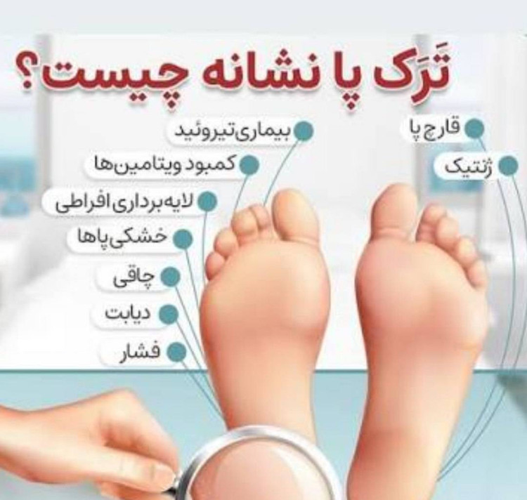 سوهان پا-از بین بردن پوست مرده پاو ترک و خشکی پاها-لطافت و نرمی پاها-افزایش زیبایی پاها-ابزار عالی برای پدیکور-کیفیت عالی قابل شستشو